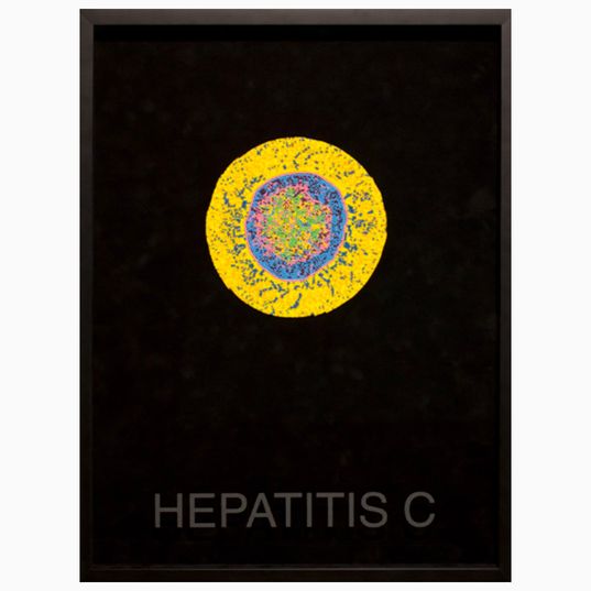 Hepatitis C. RCH61